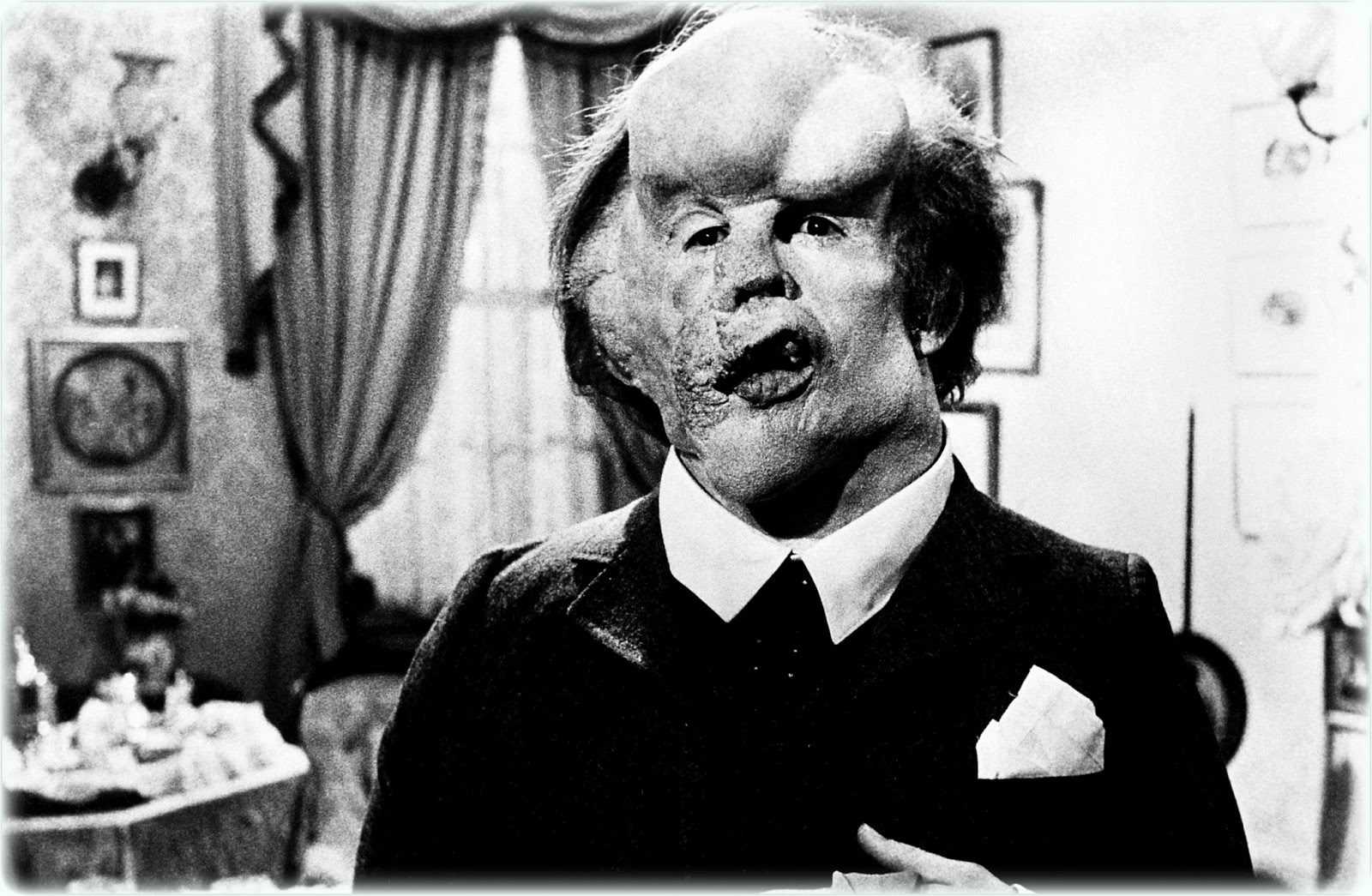 The Elephant Man: il film di David Lynch torna in sala restaurato grazie alla Cineteca di Bologna